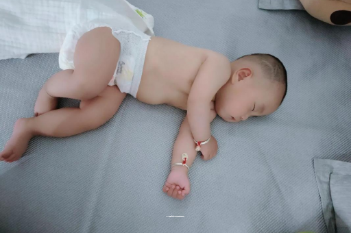 白沙宝宝头上长痱子